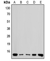 RPL36 Rabbit Polyclonal Antibody