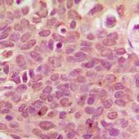 RPL36 Rabbit Polyclonal Antibody