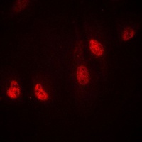 RPL36 Rabbit Polyclonal Antibody