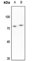 SENP3 Rabbit Polyclonal Antibody