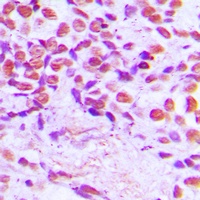 SENP3 Rabbit Polyclonal Antibody