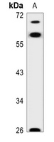 AATF Rabbit Polyclonal Antibody