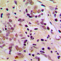 AATF Rabbit Polyclonal Antibody