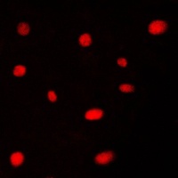 AATF Rabbit Polyclonal Antibody