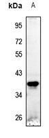 STEAP1 Rabbit Polyclonal Antibody