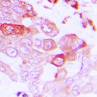 STEAP1 Rabbit Polyclonal Antibody