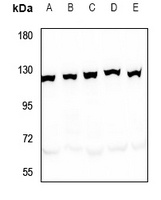 SND1 Rabbit Polyclonal Antibody