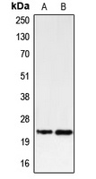 PUMA Rabbit Polyclonal Antibody