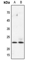 HPGDS Rabbit Polyclonal Antibody