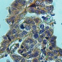 HPGDS Rabbit Polyclonal Antibody