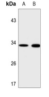 MRPL15 Rabbit Polyclonal Antibody
