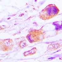 MRPL15 Rabbit Polyclonal Antibody
