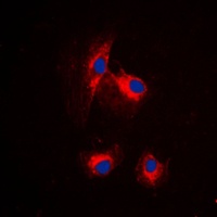 MRPL15 Rabbit Polyclonal Antibody