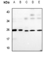 UBE2T Rabbit Polyclonal Antibody