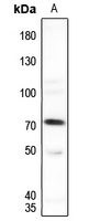 SENP1 Rabbit Polyclonal Antibody