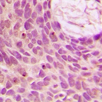 SENP1 Rabbit Polyclonal Antibody
