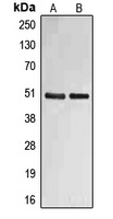 Fibulin 4 Rabbit Polyclonal Antibody