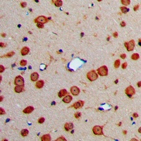 Fibulin 4 Rabbit Polyclonal Antibody