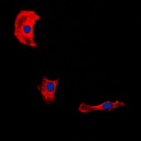 Fibulin 4 Rabbit Polyclonal Antibody