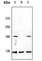 Collagen 5 alpha 3 Rabbit Polyclonal Antibody