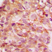 Collagen 5 alpha 3 Rabbit Polyclonal Antibody