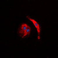 Collagen 5 alpha 3 Rabbit Polyclonal Antibody
