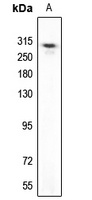 UBR5 Rabbit Polyclonal Antibody