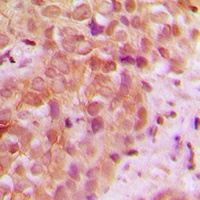 UBR5 Rabbit Polyclonal Antibody
