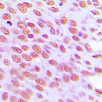 NUB1 Rabbit Polyclonal Antibody