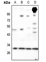 RAB23 Rabbit Polyclonal Antibody