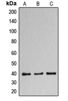 DNAJB11 Rabbit Polyclonal Antibody