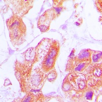 DNAJB11 Rabbit Polyclonal Antibody