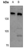 ARID4B Rabbit Polyclonal Antibody