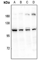 ERAP1 Rabbit Polyclonal Antibody