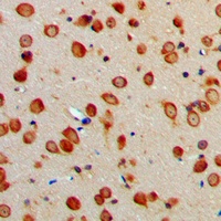 ERAP1 Rabbit Polyclonal Antibody