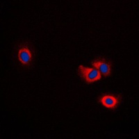 ERAP1 Rabbit Polyclonal Antibody