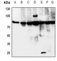 IL-20RA Rabbit Polyclonal Antibody