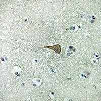 IL-20RA Rabbit Polyclonal Antibody