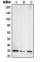 TOLLIP Rabbit Polyclonal Antibody