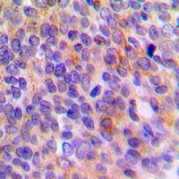 TOLLIP Rabbit Polyclonal Antibody