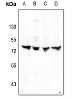 TRIM68 Rabbit Polyclonal Antibody