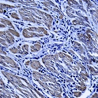 TRIM68 Rabbit Polyclonal Antibody