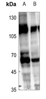 RCBTB1 Rabbit Polyclonal Antibody