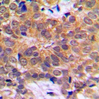 RCBTB1 Rabbit Polyclonal Antibody