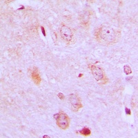 IARS2 Rabbit Polyclonal Antibody