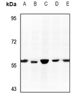 RCC2 Rabbit Polyclonal Antibody