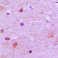 RCC2 Rabbit Polyclonal Antibody