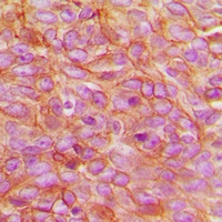PARD3 Rabbit Polyclonal Antibody