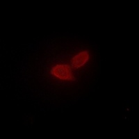 PARD3 Rabbit Polyclonal Antibody