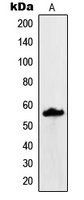 MUC13 Rabbit Polyclonal Antibody